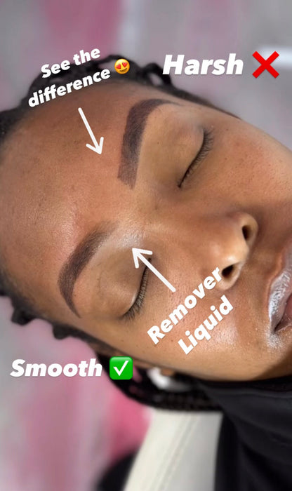 Remover Kit
